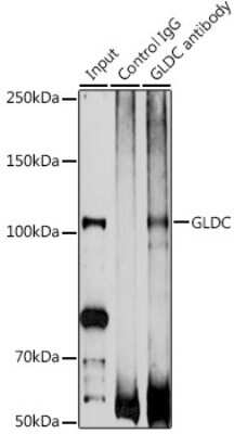 Immunoprecipitation: GLDC Antibody [NBP3-04989] - Immunoprecipitation analysis of 200ug extracts of DU145 cells using 3ug GLDC antibody (NBP3-04989). Western blot was performed from the immunoprecipitate using GLDC antibody (NBP3-04989) at a dilution of 1:1000.