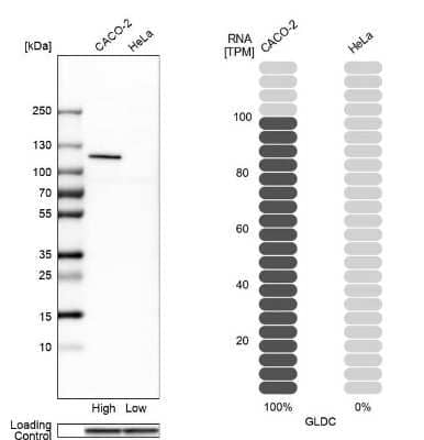 <b>Orthogonal Strategies Validation. </b>Western Blot: GLDC Antibody [NBP2-38682] - Analysis in human cell lines Caco-2 and HeLa using anti-GLDC antibody. Corresponding GLDC RNA-seq data are presented for the same cell lines. Loading control: anti-GAPDH.