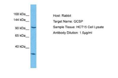 Western Blot: GLDC Antibody [NBP2-87503] - Host: Rabbit. Target Name: GCSP. Sample Type: HCT15 Whole Cell lysates. Antibody Dilution: 1.0ug/ml