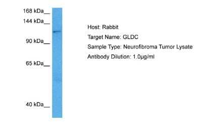 Western Blot: GLDC Antibody [NBP2-87504] - Host: Rabbit. Target Name: GLDC. Sample Tissue: Human Neurofibroma Tumor lysates. Antibody Dilution: 1ug/ml