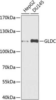 Western Blot: GLDC Antibody [NBP3-04989] - Analysis of extracts of various cell lines, using GLDC antibody at 1:1000 dilution. Secondary antibody: HRP Goat Anti-Rabbit IgG (H+L) at 1:10000 dilution. Lysates/proteins: 25ug per lane. Blocking buffer: 3% nonfat dry milk in TBST. Detection: ECL Basic