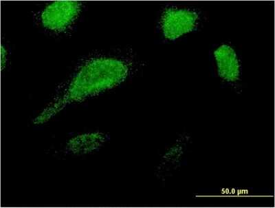 Immunocytochemistry/Immunofluorescence: GLE1 Antibody (1D8) [H00002733-M03] - Analysis of monoclonal antibody to GLE1 on HeLa cell. Antibody concentration 10 ug/ml
