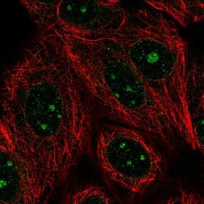 Immunocytochemistry/Immunofluorescence: GLE1 Antibody [NBP2-56561] - Staining of human cell line MCF7 shows localization to nucleoli & nuclear membrane.