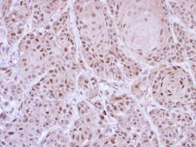 Immunohistochemistry-Paraffin: GLE1 Antibody [NBP1-32714] - Paraffin-embedded Cal27 xenograft, using antibody at 1:500 dilution.