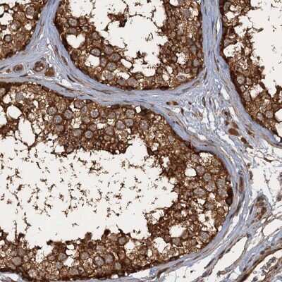 Immunohistochemistry-Paraffin: GLE1 Antibody [NBP2-47450] - Staining of human testis shows strong cytoplasmic positivity in cells in seminiferous ducts and Leydig cells.