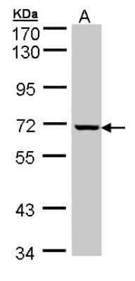 Western Blot: GLE1 Antibody [NBP1-32714] - Sample (30 ug of whole cell lysate) A: HeLa 7.5% SDS PAGE, antibody diluted at 1:1000.