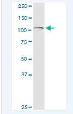 Western Blot: GLI-1 Antibody (1G11) [H00002735-M02-100ug] - Analysis of GLI1 expression in HeLa.
