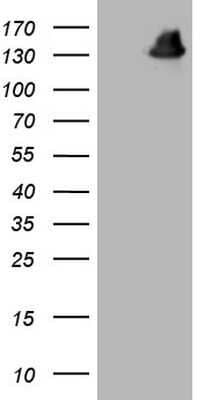 Western Blot: GLI-1 Antibody (OTI4E2) - Azide and BSA Free [NBP2-70831] - Analysis of HEK293T cells were transfected with the pCMV6-ENTRY control (Left lane) or pCMV6-ENTRY GLI1.