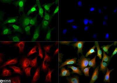 Immunocytochemistry/Immunofluorescence: GLI-2 Antibody [NBP2-23602] - GLI-2 antibody was tested in HeLa cells with DyLight 488 (green). Nuclei and alpha-tubulin were counterstained with DAPI (blue) and DyLight 550 (red). An antibody dilution of 1:50 was used. Image objective 40x.