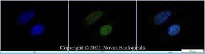 Immunocytochemistry/ Immunofluorescence GLI-2 Antibody - BSA Free