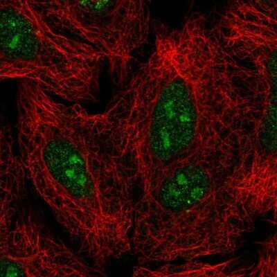 Immunocytochemistry/Immunofluorescence: GLI-2 Antibody [NBP2-57535] - Staining of human cell line A549 shows localization to nucleus & nucleoli. Antibody staining is shown in green.