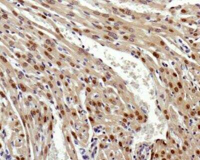 Immunohistochemistry: GLI-2 Antibody [NBP2-23602] - Analysis of GLI-2 in mouse heart.