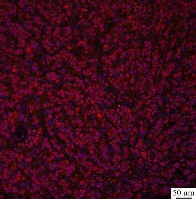 Immunohistochemistry-Paraffin: GLI-2 Antibody [NBP2-23602] - GLI-2 (red) and DAPI (blue) in mouse BT-474 primary tumors (breast cancer tissue). IHC-P image submitted by a verified customer review.