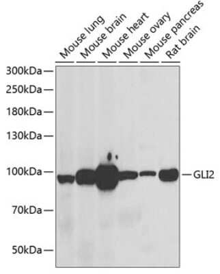 Western Blot: GLI-2 Antibody [NBP3-05613] - Western blot analysis of extracts of various cell lines, using GLI-2 antibody (NBP3-05613) at 1:1000 dilution. Secondary antibody: HRP Goat Anti-Rabbit IgG (H+L) at 1:10000 dilution. Lysates/proteins: 25ug per lane. Blocking buffer: 3% nonfat dry milk in TBST. Detection: ECL Basic Kit. Exposure time: 90s.