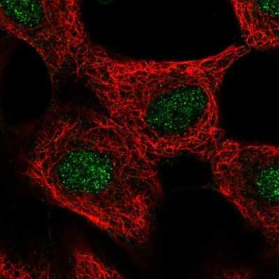Immunocytochemistry/Immunofluorescence: GLI4 Antibody [NBP2-14053] - Immunofluorescent staining of human cell line A549 shows localization to nucleus.
