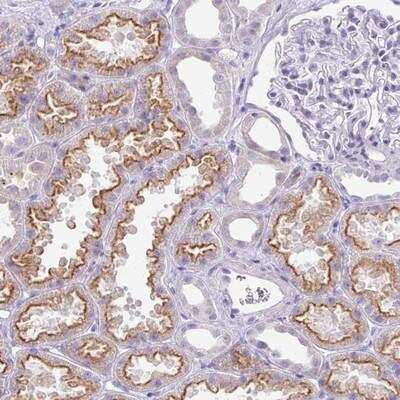 Immunohistochemistry: GLI4 Antibody [NBP2-14053] - Staining of human kidney shows distinct membranous positivity in cells in tubules.