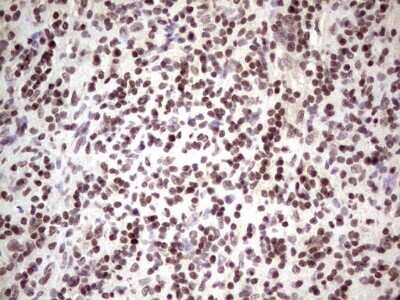 Immunohistochemistry: GLI4 Antibody (OTI3A9) - Azide and BSA Free [NBP2-70833] - Analysis of Human lymph node tissue. (Heat-induced epitope retrieval by 1 mM EDTA in 10mM Tris, pH8.5, 120C for 3min)