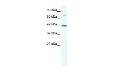 Western Blot: GLI4 Antibody [NBP2-84973] - WB Suggested Anti-GLI4 Antibody Titration: 1.25ug/ml. ELISA Titer: 1:312500. Positive Control: Jurkat cell lysate