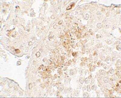 Immunohistochemistry GLIPR1L1 Antibody - BSA Free