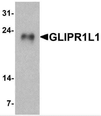 GLIPR1L2 Antibody [Janelia Fluor® 635] (NBP2-82092JF635): Novus Biologicals