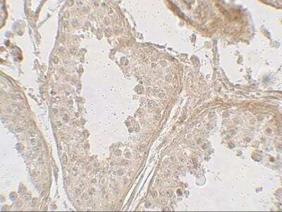 Immunohistochemistry GLIPR1L2 Antibody - BSA Free