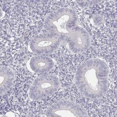 <b>Orthogonal Strategies Validation. </b>Immunohistochemistry-Paraffin: GLIPR1L2 Antibody [NBP1-81091] - Staining of human endometrium shows low expression as expected.