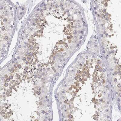 Immunohistochemistry-Paraffin: GLIPR1L2 Antibody [NBP1-81091] - Staining of human testis shows high expression.