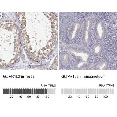 <b>Orthogonal Strategies Validation. </b>Immunohistochemistry-Paraffin: GLIPR1L2 Antibody [NBP1-81092] - Staining in human testis and endometrium tissues using anti-GLIPR1L2 antibody. Corresponding GLIPR1L2 RNA-seq data are presented for the same tissues.