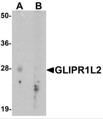 Western Blot GLIPR1L2 Antibody - BSA Free