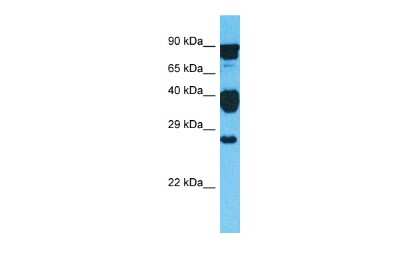 Western Blot: GLIPR1L2 Antibody [NBP2-87505] - Host: Rabbit. Target Name: GLIPR1L2. Sample Type: Hela Whole Cell lysates. Antibody Dilution: 1.0ug/ml