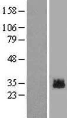 Western Blot: GLIPR1L2 Overexpression Lysate (Adult Normal) [NBL1-11113] Left-Empty vector transfected control cell lysate (HEK293 cell lysate); Right -Over-expression Lysate for GLIPR1L2.