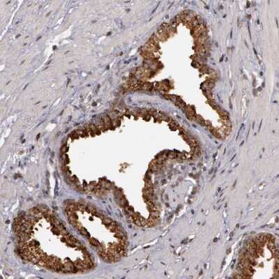 Immunohistochemistry-Paraffin: GLIS1 Antibody [NBP1-83492] - Staining of human prostate shows strong cytoplasmic positivity in glandular cells.