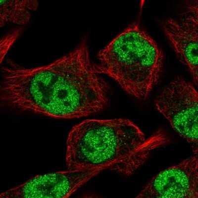 Immunocytochemistry/ Immunofluorescence GLIS3 Antibody