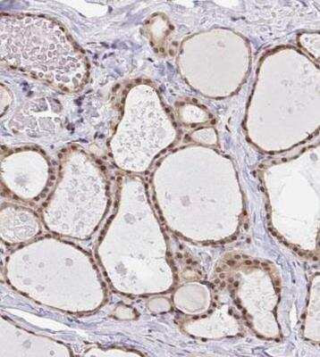 Immunohistochemistry-Paraffin GLIS3 Antibody