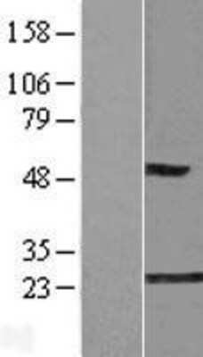 Western Blot Glyoxalase I Overexpression Lysate