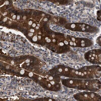 Immunohistochemistry-Paraffin GLOD4 Antibody