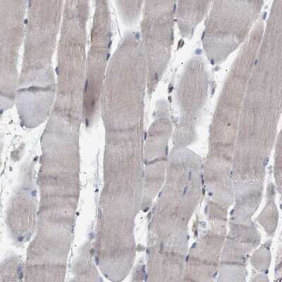 Immunohistochemistry-Paraffin GLOD4 Antibody