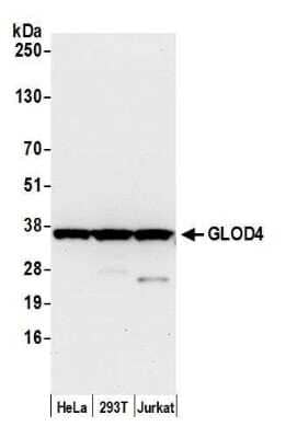 Western Blot: GLOD4 Antibody [NBP2-60713] - Detection of human GLOD4 by western blot. Samples: Whole cell lysate (15 ug) from HeLa, 293T, and Jurkat cells prepared using NETN lysis buffer. Antibody: Affinity purified rabbit anti-GLOD4 antibody NBP2-60713 used for WB at 1:1000. Detection: Chemiluminescence with an exposure time of 10 seconds