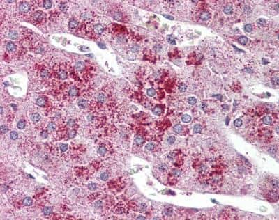 Immunohistochemistry-Paraffin: GLP-2R Antibody [NBP1-44281] - Analysis of anti-GLP2R antibody with human adrenal.