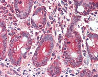 Immunohistochemistry-Paraffin: GLP-2R Antibody [NBP1-44281] - Analysis of anti-GLP2R antibody with human, small intestine.
