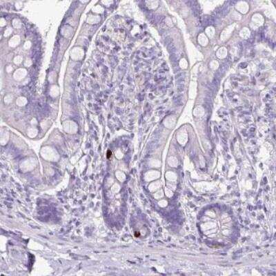 Immunohistochemistry-Paraffin: GLP-2R Antibody [NBP2-33557] - Staining of human small intestine shows strong cytoplasmic positivity in enteroendocrine cells.