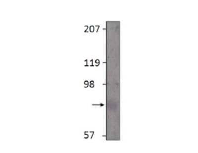 GLP-2R Antibody [NBP3-12309] - 1:500 antibody dilution in DiluObuffer.