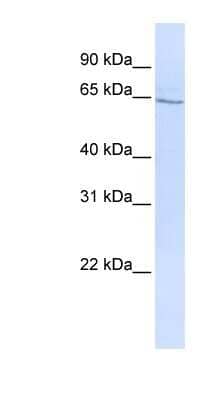 Western Blot: GLP2R Antibody [NBP1-59029] - HepG2 cell lysate, concentration 0.2-1 ug/ml.