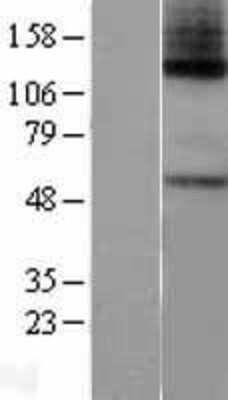 Western Blot: GLP2R Overexpression Lysate (Adult Normal) [NBP2-04270] Left-Empty vector transfected control cell lysate (HEK293 cell lysate); Right -Over-expression Lysate for GLP2R.