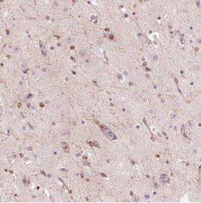 Immunohistochemistry: GLRB Antibody [NBP2-30683] - Staining of human cerebral cortex shows cytoplasmic positivity in a subset of glial cells.