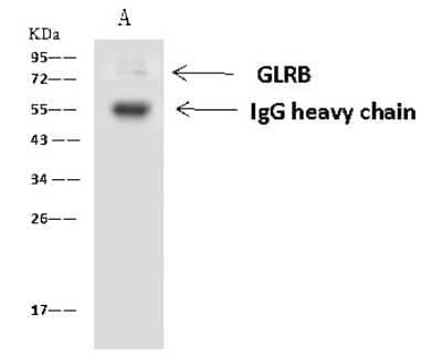 Immunoprecipitation: GLRB Antibody [NBP2-97806] - GLRB was immunoprecipitated using: Lane A: 0.5 mg Jurkat Whole Cell Lysate 4 ul anti-GLRB rabbit polyclonal antibody and 60 ug of Immunomagnetic beads Protein A/G.  Primary antibody: Anti-GLRB rabbit polyclonal antibody, at 1:100 dilution. Secondary antibody: Goat Anti-Rabbit IgG (H+L)/HRP at 1/10000 dilution. Developed using the ECL technique. Performed under reducing conditions. Predicted band size: 56 kDa. Observed band size: 72 kDa