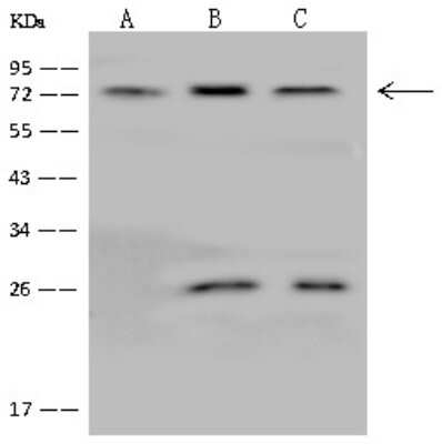 Western Blot: GLRB Antibody [NBP2-97806] - Anti-GLRB rabbit polyclonal antibody at 1:500 dilution. Lane A: K562 Whole Cell Lysate Lane B: Jurkat Whole Cell Lysate Lane C: U-251 MG Whole Cell Lysate Lysates/proteins at 30 ug per lane. Secondary Goat Anti-Rabbit IgG (H+L)/HRP at 1/10000 dilution. Developed using the ECL technique. Performed under reducing conditions. Predicted band size: 56 kDa. Observed band size: 72 kDa