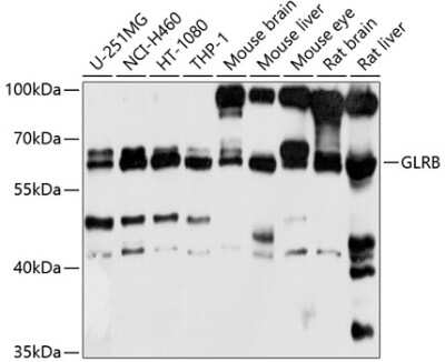 Western Blot: GLRB Antibody [NBP3-04875] - Analysis of extracts of various cell lines, using GLRB antibody at 1:1000 dilution. Secondary antibody: HRP Goat Anti-Rabbit IgG (H+L) at 1:10000 dilution. Lysates/proteins: 25ug per lane. Blocking buffer: 3% nonfat dry milk in TBST. Detection: ECL Basic Kit