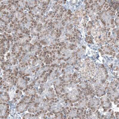 Immunohistochemistry-Paraffin: GLS2 Antibody (CL7716) [NBP2-88907] - Staining of human pancreas shows moderate granular cytoplasmic positivity in exocrine glandular cells.