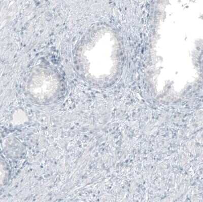 Immunohistochemistry-Paraffin: GLS2 Antibody (CL7716) [NBP2-88907] - Staining of human prostate shows no positivity in glandular cells as expected.